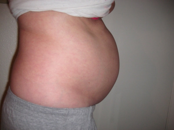 Do You Have Extreme Bloating What Causes The Belly To Bloat Severely 